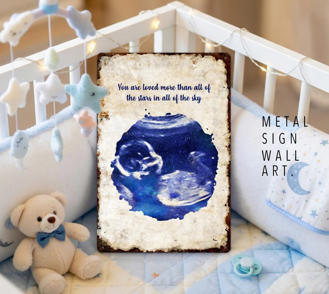 Custom Baby Scan Print Personalized Ultrasound Art