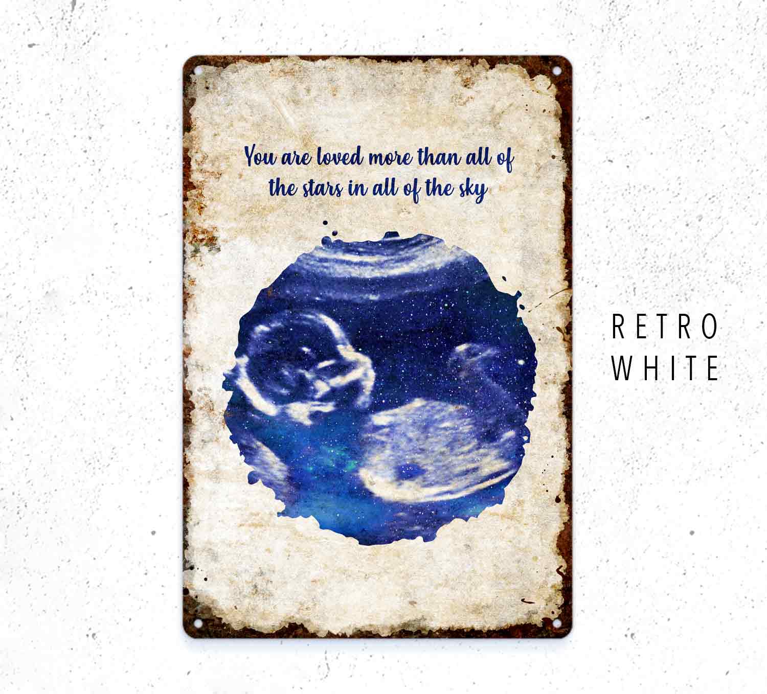 Custom Baby Scan Sign – Personalized Ultrasound Wall Art Gift