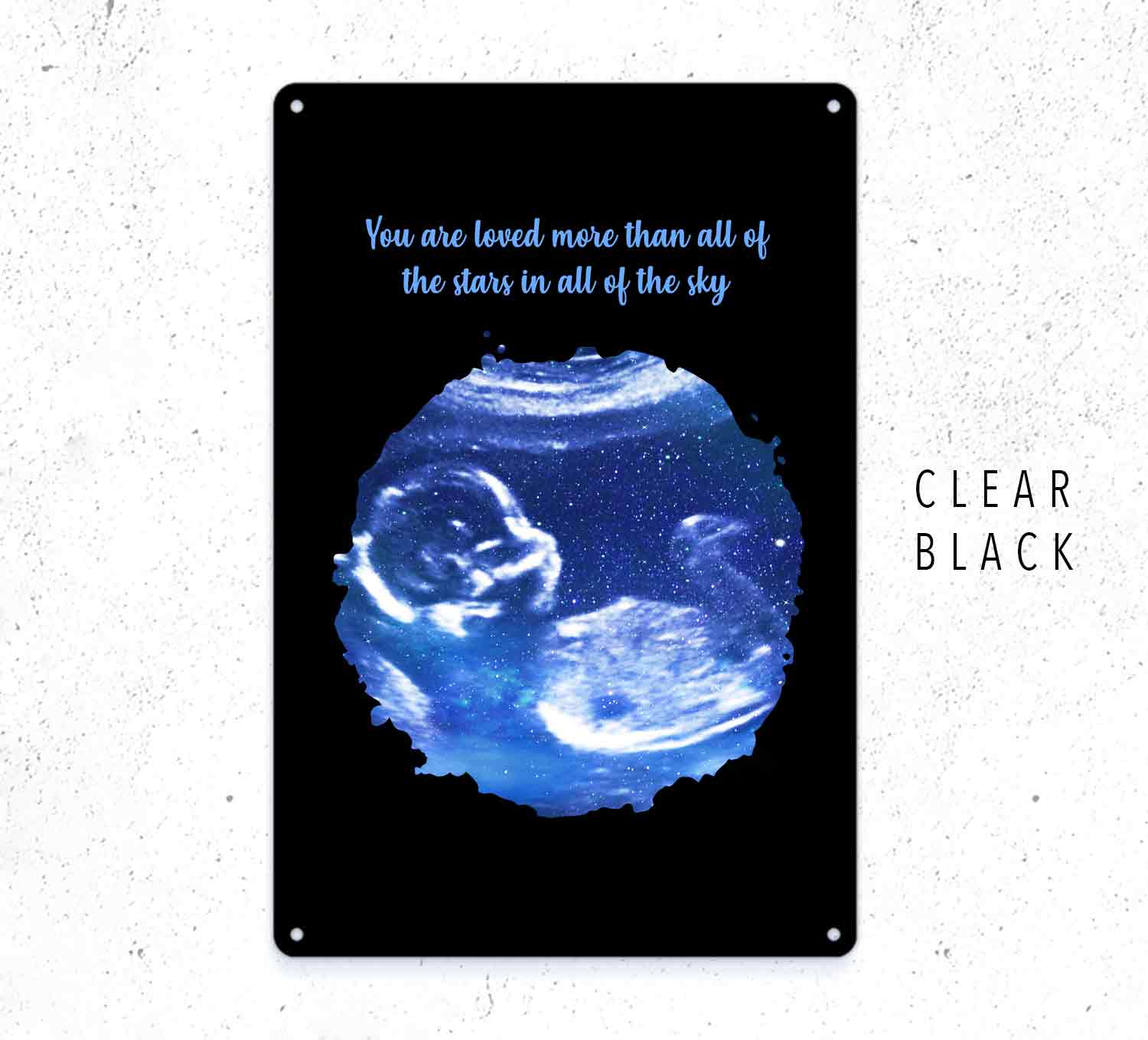 Custom Baby Scan Sign – Personalized Ultrasound Wall Art Gift