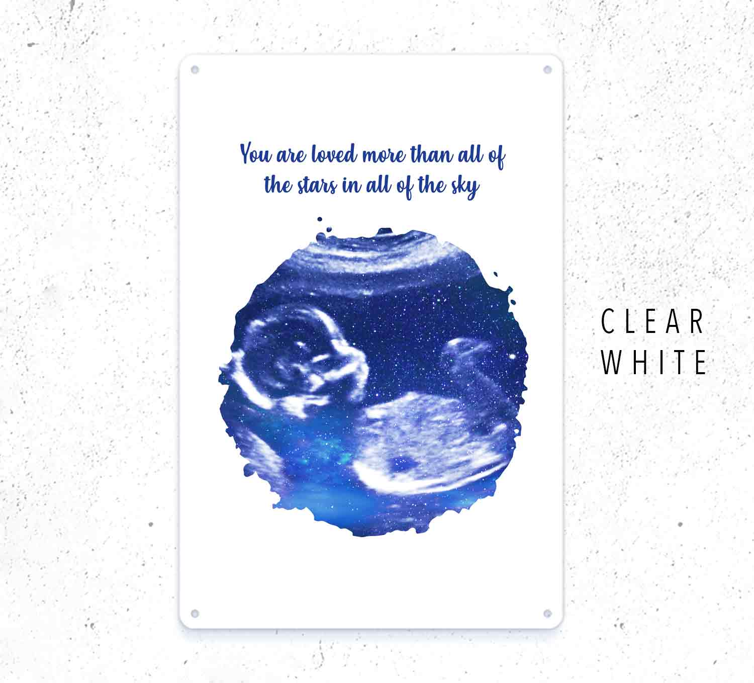 Custom Baby Scan Sign – Personalized Ultrasound Wall Art Gift
