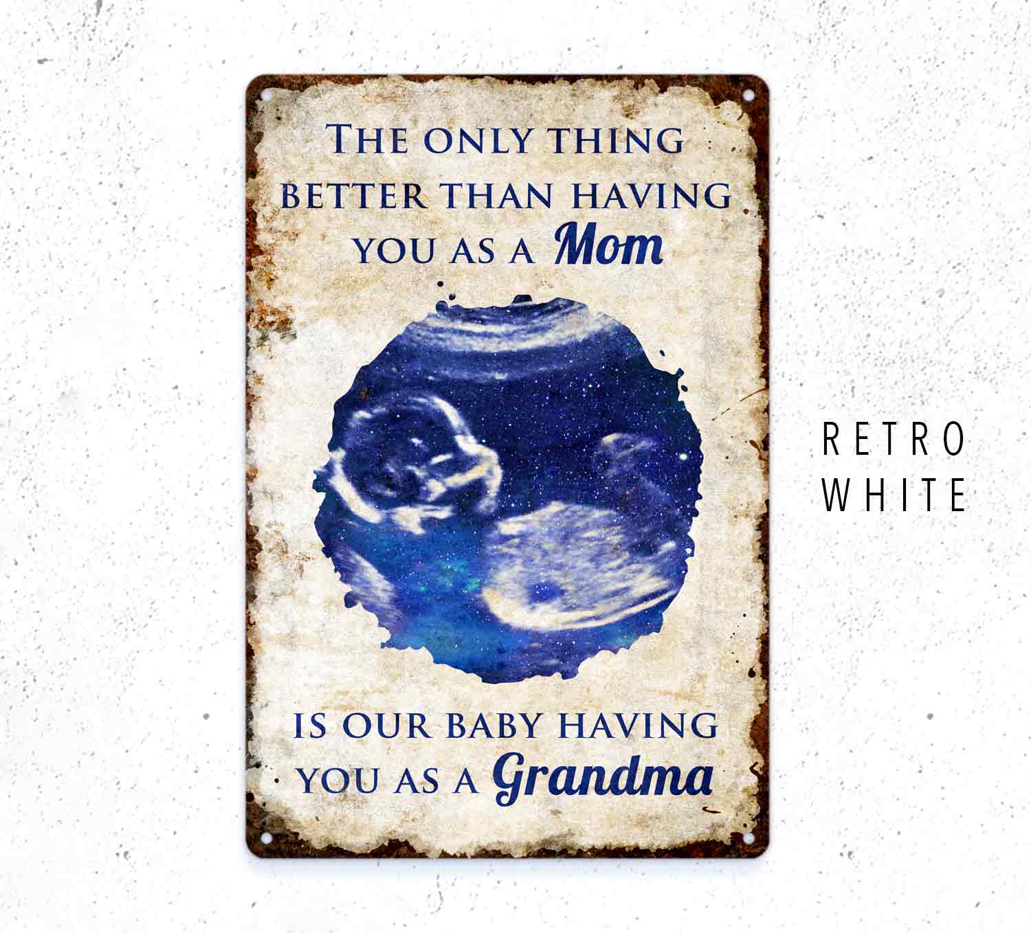 Custom Baby Scan Metal Sign – Personalized Pregnancy Ultrasound Keepsake Gift Grandma Gift