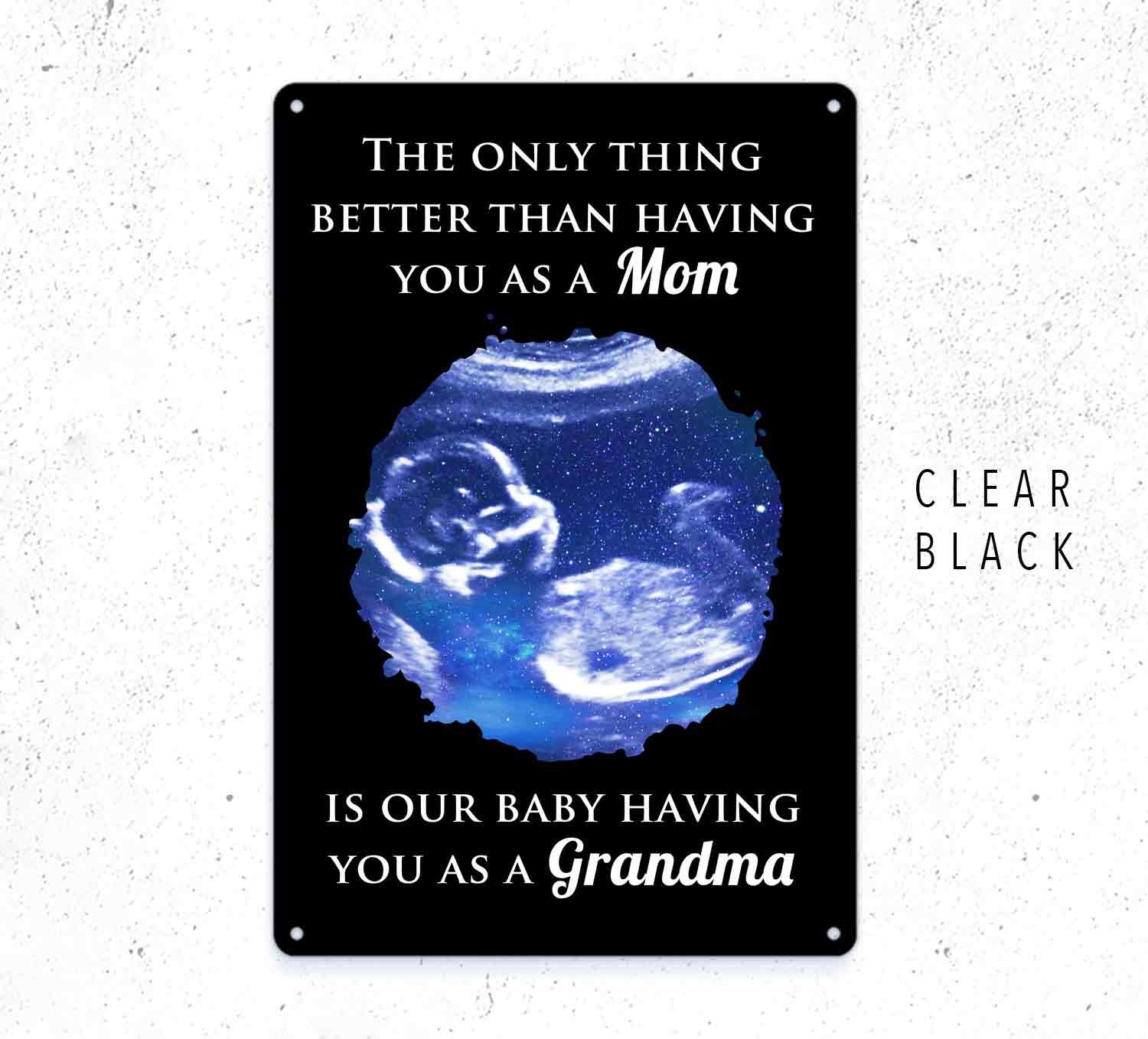 Custom Baby Scan Metal Sign – Personalized Pregnancy Ultrasound Keepsake Gift Grandma Gift
