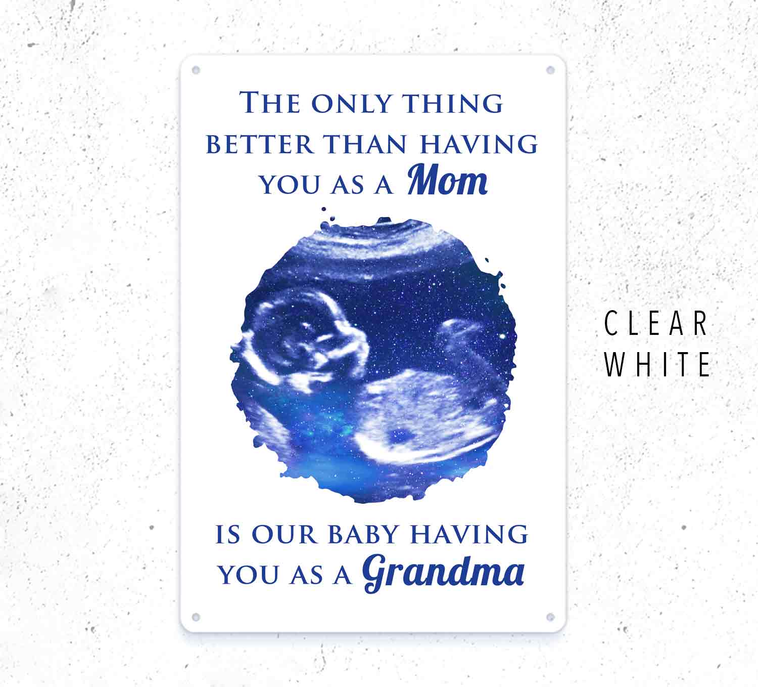 Custom Baby Scan Metal Sign – Personalized Pregnancy Ultrasound Keepsake Gift Grandma Gift